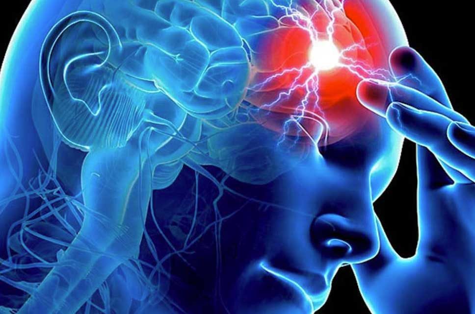 Ventinove ottobre, giornata mondiale dell’ictus cerebrale.