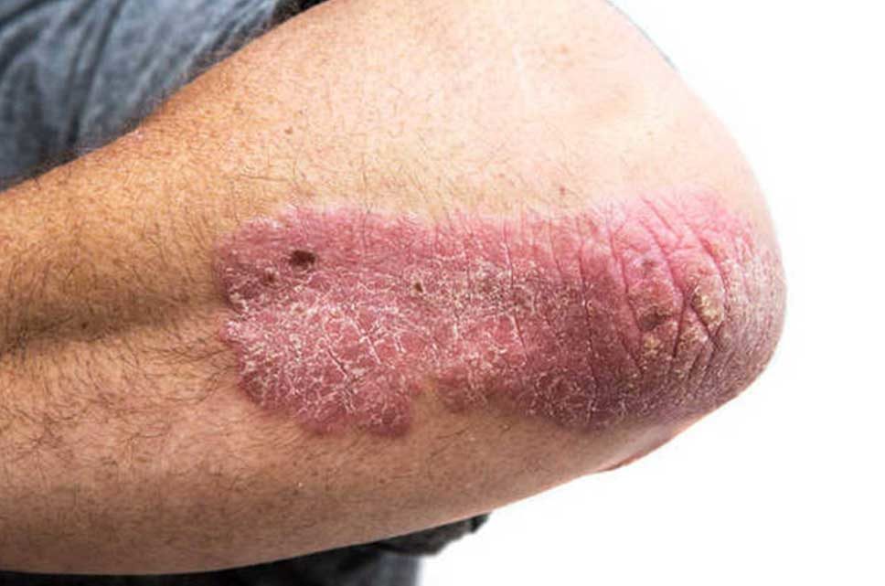 Dermatologia 2.0, per fare il punto sulle nuove cure