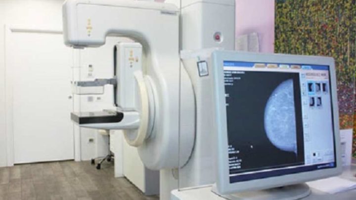 Mammografia a partire dai 40 anni, ecco come potrebbe cambiare lo screening