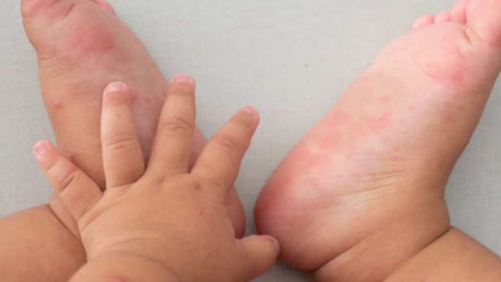 Neonato bulgaro viene alla luce con anticorpi al Coronavirus