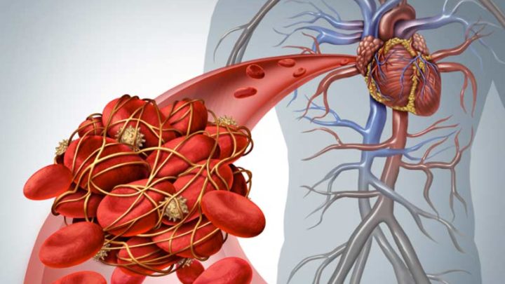 Ipercolesterolemia, app calcola il rischio cardiovascolare a dieci anni