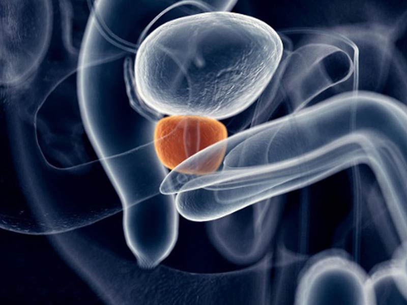 Cancro alla prostata, ventidue pesticidi collegati
