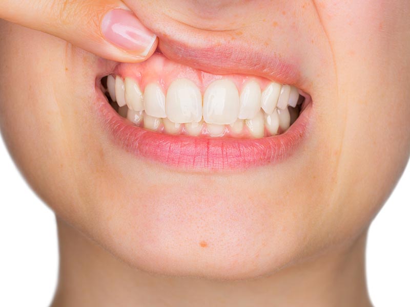 Una bocca a prova di sorriso