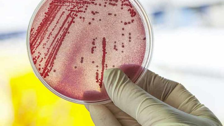 Antibioticoresistenza, c’è Spincar