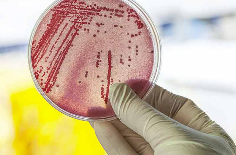 Antibioticoresistenza, c’è Spincar