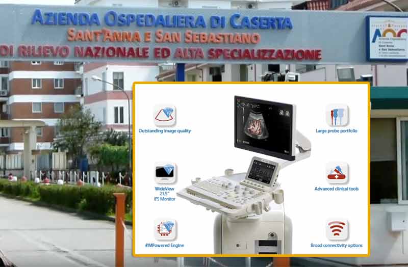 Aorn Caserta: un nuovo ecografo per i trapiantati