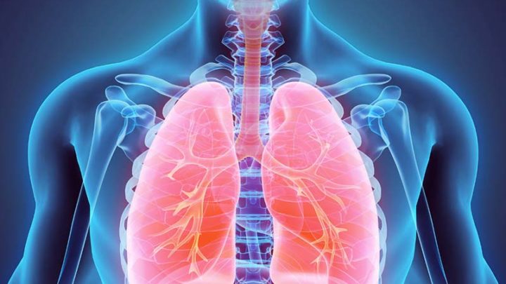 Covid e influenza gravi, possibile aumento del rischio di tumore polmonare