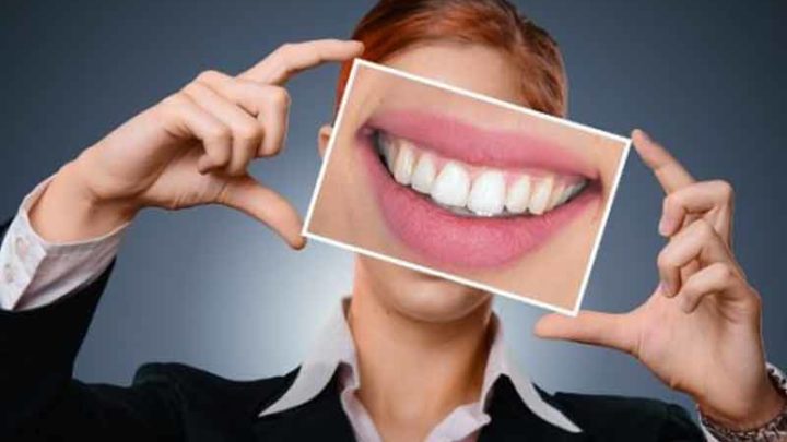 Dentatura da reclame