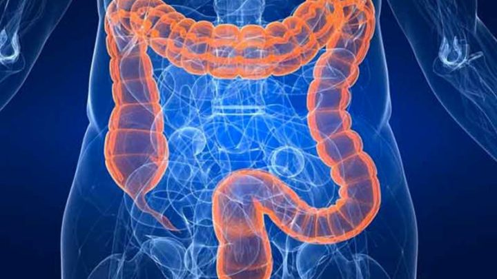 Il Covid può contrastare il tumore al colon?