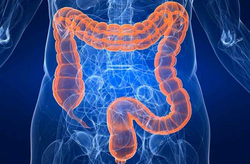 Il Covid può contrastare il tumore al colon?