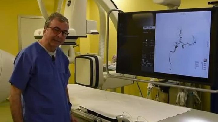 Neuroradiologia, l’intervento precoce salva la vita