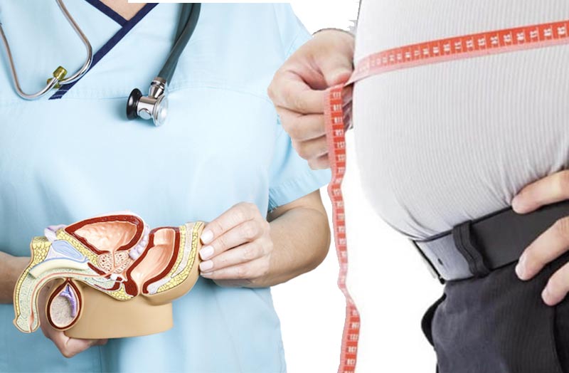 Il peso in eccesso genera problemi urologici