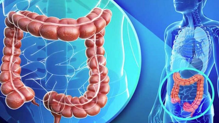 Neoplasie, calano i tumori del colon