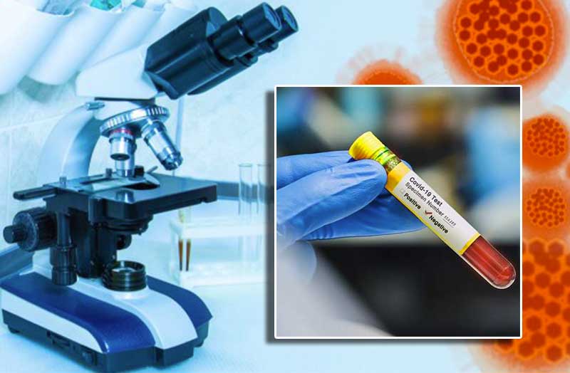 Covid-19, da domani test rapidi per gli operatori della sanità