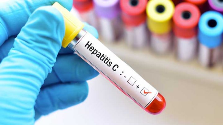 Aifa, presentati i dati sui trattamenti per l’HCV