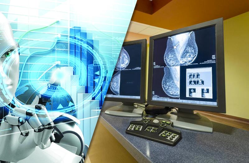 Cancro al seno, quando la diagnosi la fa un robot