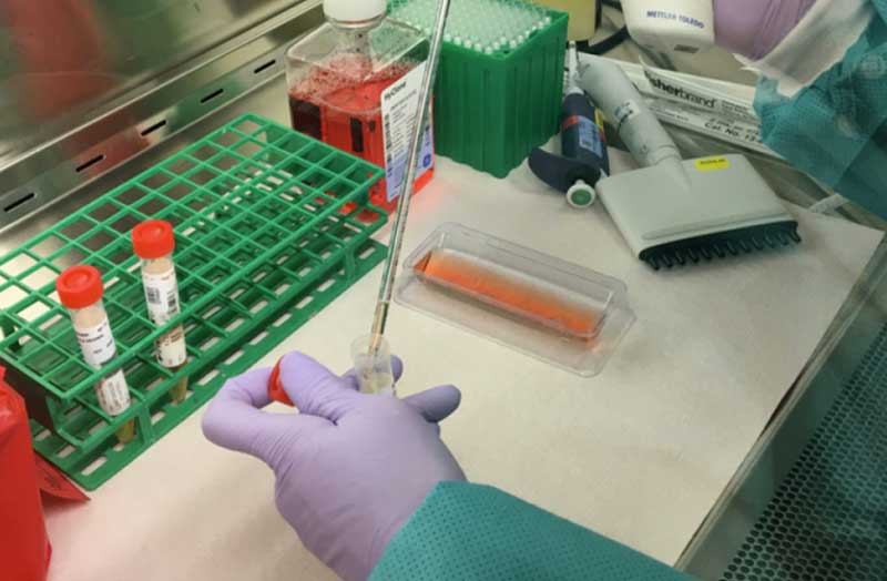 Coronavirus, risalgono i contagi