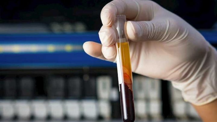 Covid-19, ancora un contagio nel salernitano