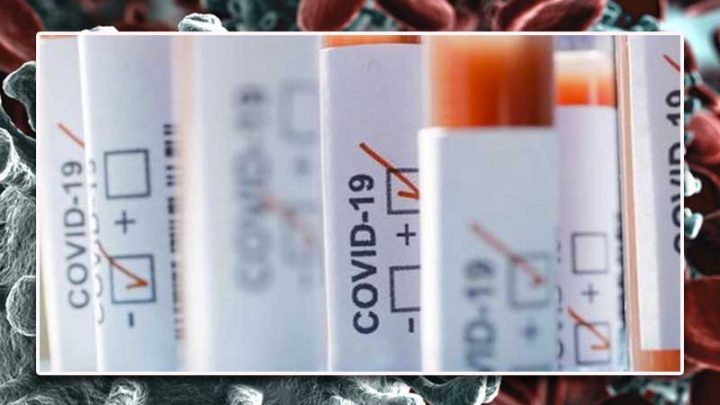Quattro casi di positività al Coronavirus a Massa Lubrense