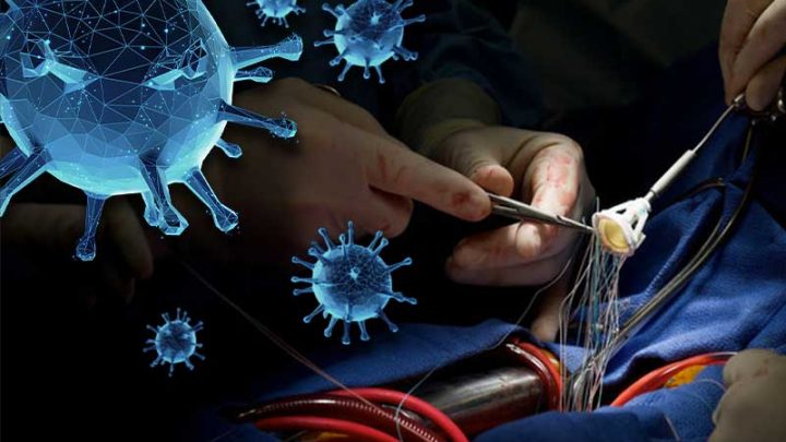 Pandemia, forte impatto sulla mortalità per infarto
