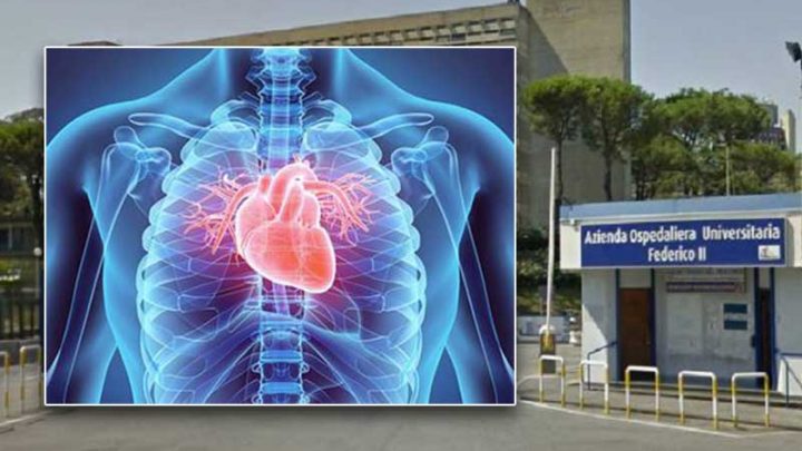 Campania a rischio cuore 30% di angioplastiche in meno