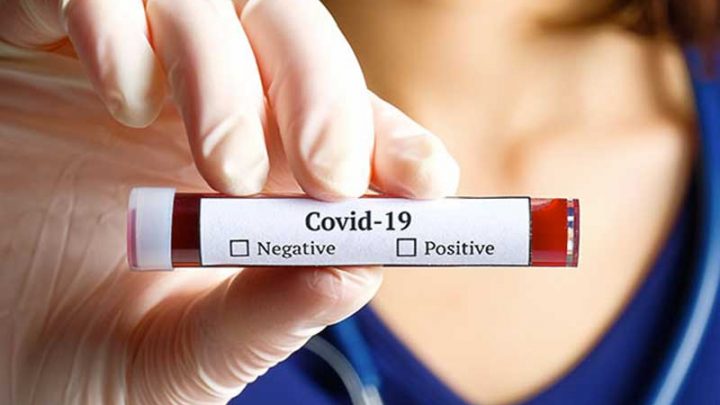 Quando il test anticovid non “dice la verità”