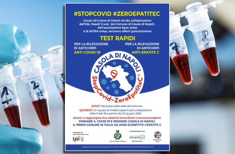 Parte il progetto “Casola di Napoli Zero epatite C – Stop Covid”