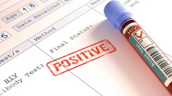 Le città italiane si attrezzano per eliminare entro il 2030 Hiv e Epatite C come target dell’Oms