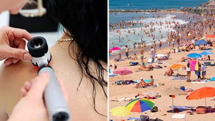 Melanoma, la prevenzione ti segue in vacanza