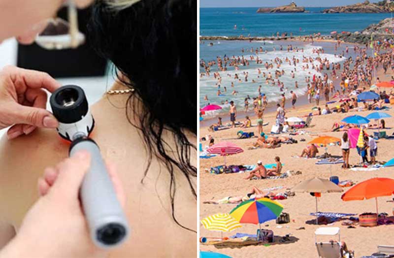 Melanoma, la prevenzione ti segue in vacanza