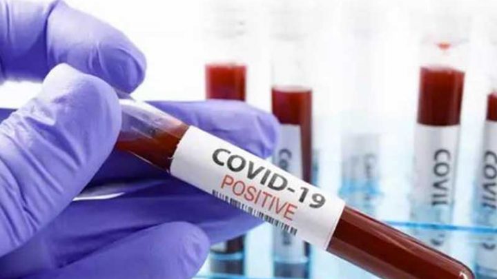 Nuovo caso di positività al Coronavirus a Cava de’ Tirreni