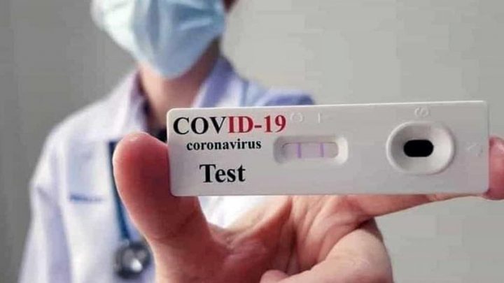 Covid, sarà disponibile a breve il test per le varianti