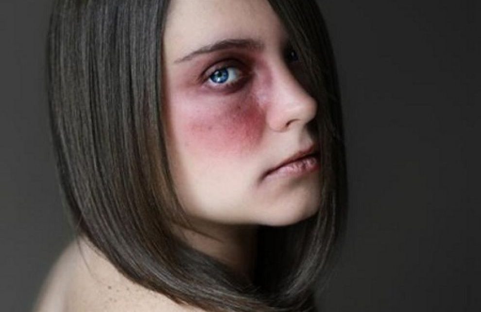 Ariano Irpino, al via l’(H)Open Week contro la violenza sulle donne: visite gratuite, seminari e supporto psicologico