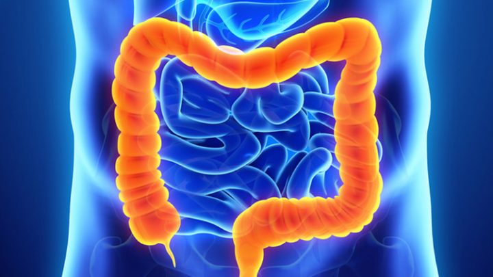 Malattie infiammatorie croniche intestinali nelle donne: “Insieme si può”