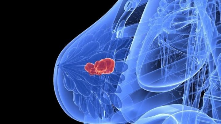 Prevenzione oncolgica, Asl Av: sabato prossimo screening seno e colon retto