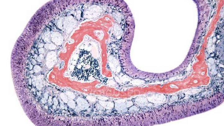 Il Covid-19 può cancellare del tutto la percezione degli odori