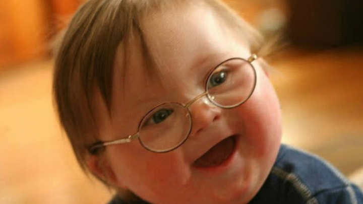 Si celebra oggi la giornata mondiale della sindrome di Down