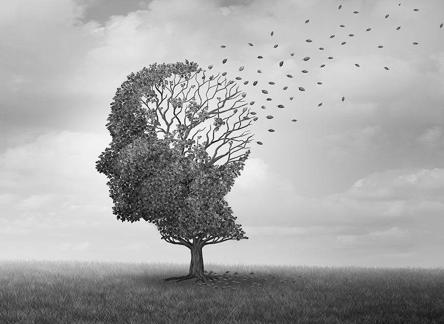 Alzheimer e scarsa qualità del sonno, dimostrato legame diretto