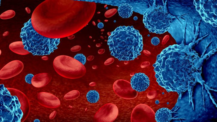 Aifa, in arrivo nuovo trattamento su pazienti con Mieloma Multiplo