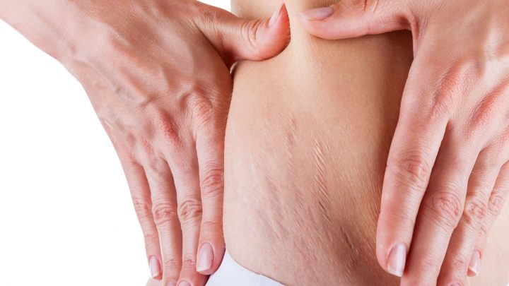 Tumore dell’Ipofisi, nuovo farmaco contro la sindrome di Cushing