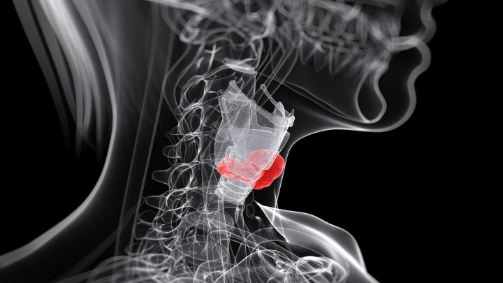 Cancro della tiroide: supporto dalla fitoterapia