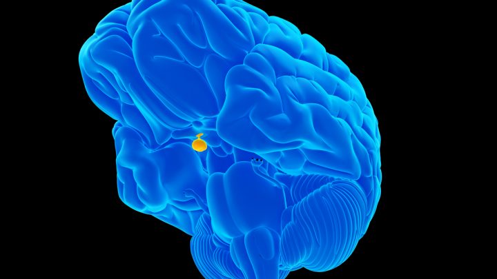 Adenomi ipofisari silenti, valutazione del rischio metabolico e cardio-vascolare