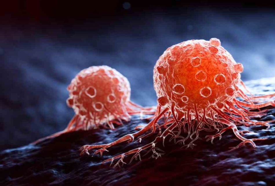 Tumori, per il 2025 si stima una diminuzione dei tassi di mortalità