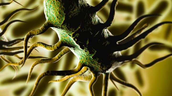 Listeria, nel 2022 l’Italia terza in Europa per casi