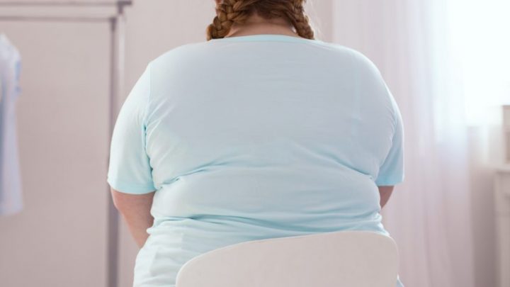 Long-Covid: donne in sovrappeso sono le più colpite
