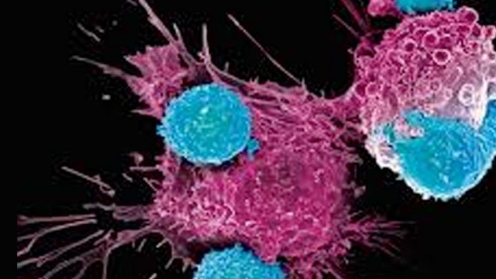 Terapie con CAR-T, la Campania all’avanguardia nella cura a malattie oncologiche e oncoematologiche 