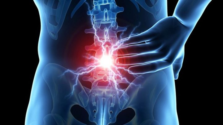 Lombalgia acuta, ecco i farmaci più efficaci per il trattamento