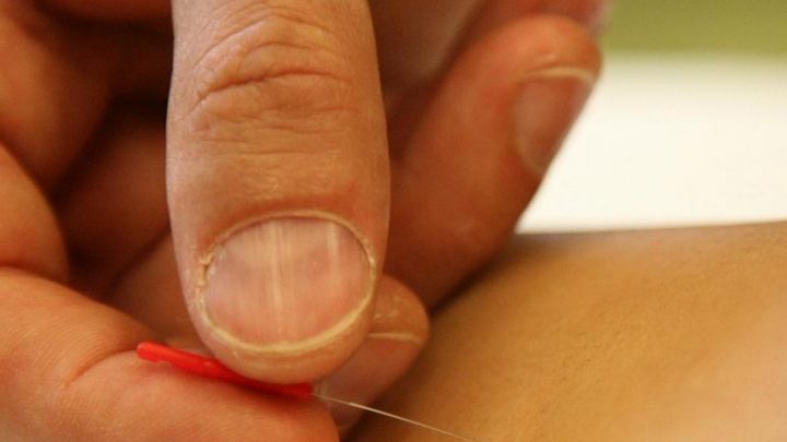 L’ago puntura contro i disturbi del sonno nelle donne con tumore al seno