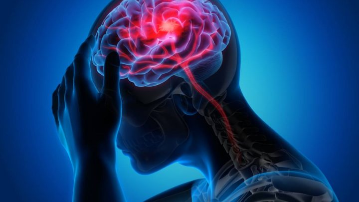 Emorragia cerebrale da anticoagulanti, disponibile nuova strategia terapeutica
