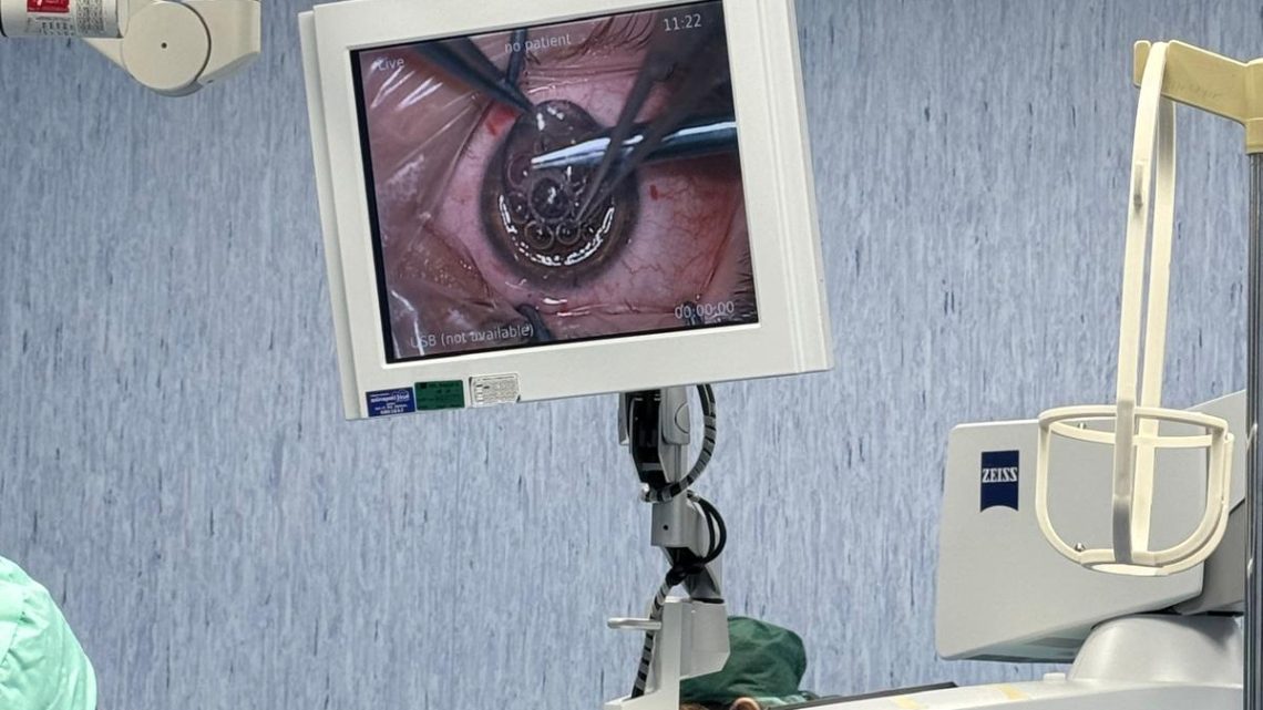 Ospedale Boscotrecase, col trapianto di cornee 25enne ritrova la vista